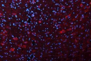 IF analysis of GLS using anti-GLS antibody (ABIN7601603). (Glutaminase anticorps  (AA 396-654))