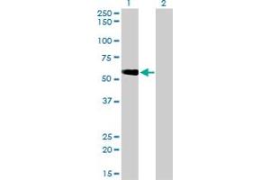 Western Blotting (WB) image for anti-Target of Myb 1 (TOM1) (AA 394-492) antibody (ABIN599110) (TOM1 anticorps  (AA 394-492))