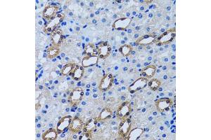 Immunohistochemistry of paraffin-embedded rat kidney using IMPA1 antibody (ABIN2563424) at dilution of 1:100 (40x lens). (IMPA1 anticorps)