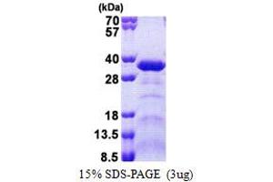 SDS-PAGE (SDS) image for Sperm Associated Antigen 7 (SPAG7) (AA 1-227) protein (His tag) (ABIN5853163)