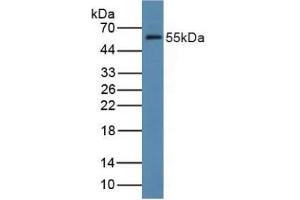 Western blot analysis of Rat Liver Tissue. (FDFT1 anticorps  (AA 269-417))