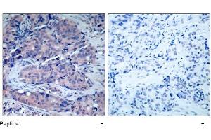 Image no. 1 for anti-Mitogen-Activated Protein Kinase Kinase 4 (MAP2K4) (Thr261) antibody (ABIN197323) (MAP2K4 anticorps  (Thr261))