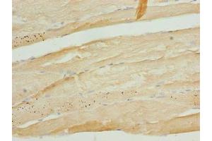 Immunohistochemistry of paraffin-embedded human skeletal muscle tissue using ABIN7173467 at dilution of 1:100 (TRIM55 anticorps  (AA 101-300))