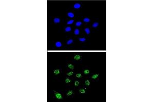 Confocal immunofluorescent analysis of DKC1 Antibody (Center) (ABIN651670 and ABIN2840353) with 293 cell followed by Alexa Fluor® 488-conjugated goat anti-rabbit lgG (green). (DKC1 anticorps  (AA 185-213))