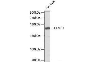 Western blot analysis of extracts of Rat liver using LAMB3 Polyclonal Antibody at dilution of 1:1000. (Laminin beta 3 anticorps)