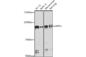 Western blot analysis of extracts of various cell lines, using  Rabbit mAb (ABIN7265443) at 1:1000 dilution.