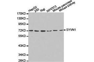 Western Blotting (WB) image for anti-Synovial Apoptosis Inhibitor 1, Synoviolin (SYVN1) antibody (ABIN1875011) (SYVN1 anticorps)