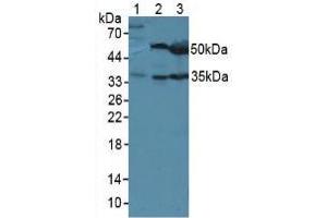 Western blot analysis of (1) Mouse Sp2/0 Cells, (2) Mouse Liver Tissue and (3) Mouse Pancreas Tissue. (LRG1 anticorps  (AA 136-342))