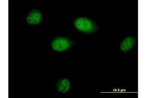 Immunofluorescence of purified MaxPab antibody to BAT3 on HeLa cell. (BAT3 anticorps  (AA 1-1126))