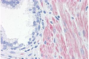 Human Prostate: Formalin-Fixed, Paraffin-Embedded (FFPE)