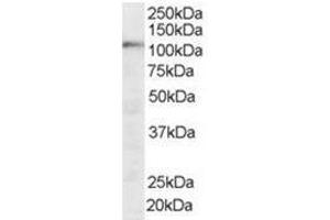 Image no. 1 for anti-Squamous Cell Carcinoma Antigen Recognized By T Cells (SART1) (N-Term) antibody (ABIN374288) (SART1 anticorps  (N-Term))