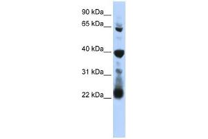 RPUSD3 antibody used at 1 ug/ml to detect target protein.