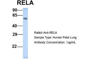 Host: Rabbit  Target Name: RELA  Sample Tissue: Human Fetal Lung  Antibody Dilution: 1. (NF-kB p65 anticorps  (Middle Region))