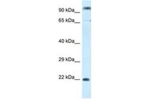 Image no. 1 for anti-Polymerase (RNA) III (DNA Directed) Polypeptide G (32kD)-Like (POLR3GL) (C-Term) antibody (ABIN6747444)