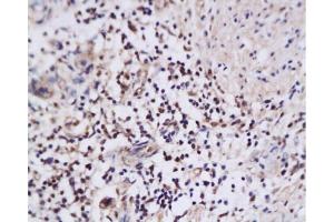 Immunohistochemistry (Paraffin-embedded Sections) (IHC (p)) image for anti-Nuclear Apoptosis Inducing Factor 1 (NAIF1) (AA 3-85) antibody (ABIN668796) (NAIF1 anticorps  (AA 3-85))