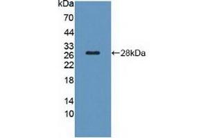 Detection of Recombinant TSHR, Rat using Polyclonal Antibody to Thyroid Stimulating Hormone Receptor (TSHR)