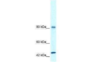 WB Suggested Anti-RBM10 Antibody Titration: 1. (RBM10 anticorps  (N-Term))