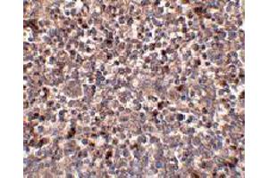 Immunohistochemistry of PIGY in human spleen tissue with PIGY polyclonal antibody  at 2. (PIGY anticorps  (C-Term))