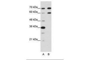 Image no. 2 for anti-Doublesex and Mab-3 Related Transcription Factor 2 (DMRT2) (N-Term) antibody (ABIN203207) (DMRT2 anticorps  (N-Term))