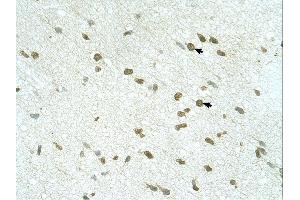 RNF168 antibody was used for immunohistochemistry at a concentration of 4-8 ug/ml.