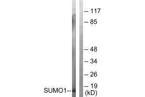 Western blot analysis of extracts from 293 cells, using Sumo1 antibody. (SUMO1 anticorps  (N-Term))