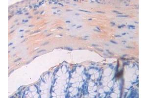 Detection of CD34 in Mouse Colon Tissue using Polyclonal Antibody to Cluster Of Differentiation 34 (CD34)