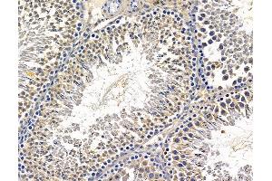ABIN7095903 and ABIN7099965 at 1/100 staining rat testis tissue by IHC-P. (PAN3 anticorps)