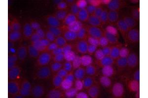 Immunofluorescence staining of methanol-fixed MCF cells using Phospho-ESR1-S106 antibody. (Estrogen Receptor alpha anticorps  (pSer106))