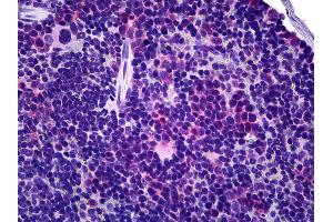 Anti-TCR Gamma/Delta antibody IHC of mouse spleen. (TCR gamma + TCR delta anticorps (FITC))