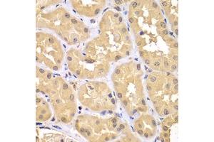Immunohistochemistry of paraffin-embedded human kidney using TRIM69 antibody (ABIN7270998) at dilution of 1:100 (40x lens). (TRIM69 anticorps  (AA 1-341))