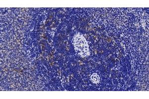 Detection of IL1RAP in Rat Spleen Tissue using Polyclonal Antibody to Interleukin 1 Receptor Accessory Protein (IL1RAP)