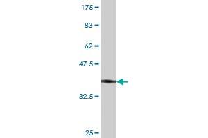 Western Blot detection against Immunogen (37. (VIPR2 anticorps  (AA 24-126))