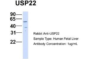 Host: Rabbit   Target Name: USP22   Sample Tissue: Human Fetal Liver  Antibody Dilution: 1.