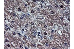 Immunohistochemistry (IHC) image for anti-alpha-Fetoprotein (AFP) (AA 19-397) antibody (ABIN2716010)