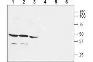 Western blot analysis of rat brain (lanes 1 and 4), mouse brain (lanes 2 and 5) and rat lung (lanes 3 and 6) membranes: - 1-3. (GPER anticorps  (C-Term, Intracellular))