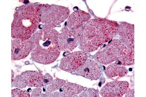 Anti-TPRA1 / GPR175 antibody IHC of human cardiac myocytes.