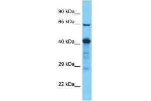 Host:  Rabbit  Target Name:  SLC22A7  Sample Tissue:  Human Esophagus Tumor  Antibody Dilution:  1ug/ml