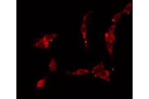 ABIN6277157 staining HuvEc cells by IF/ICC. (KRT17 anticorps  (C-Term))
