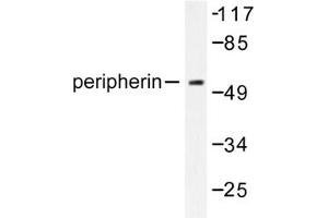 Image no. 1 for anti-Peripherin (PRPH) antibody (ABIN271783) (Peripherin anticorps)