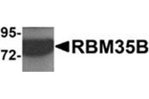 Western blot analysis of RBM35B in human lung tissue lysate with RBM35B antibody at 1 μg/ml. (ESRP2 anticorps  (C-Term))