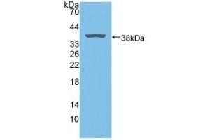 Detection of Recombinant BLVRA, Rat using Polyclonal Antibody to Biliverdin Reductase A (BLVRA) (Biliverdin Reductase anticorps  (AA 10-279))