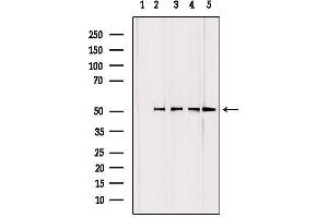 Western blot analysis of extracts from various samples, using GCSc-γ Antibody. (GCLC anticorps  (N-Term))