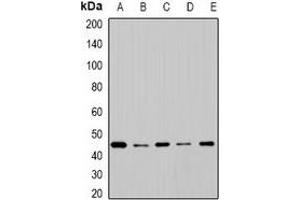 Western blot analysis of Cytochrome P450 2F1 expression in SW620 (A), BT474 (B), mouse lung (C), mouse liver (D), rat brain (E) whole cell lysates. (CYP2F1 anticorps)