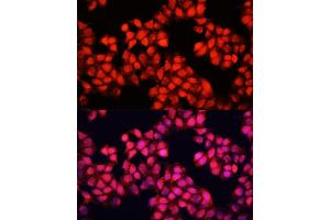 Immunofluorescence analysis of HeLa cells using ALAD antibody (ABIN6129891, ABIN6136749, ABIN6136751 and ABIN6216012) at dilution of 1:100. (ALAD anticorps  (AA 1-330))