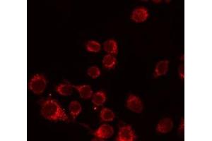 ABIN6276494 staining Hela by IF/ICC. (ALPL anticorps  (Internal Region))