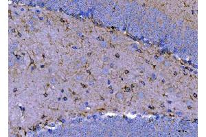 IHC analysis of Septin 2/SEPTIN2 using anti-Septin 2/SEPTIN2 antibody (ABIN7599275). (Septin 2 anticorps  (AA 1-326))