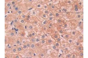 Detection of SAP in Human Liver Tissue using Polyclonal Antibody to Serum Amyloid P Component (SAP) (APCS anticorps  (AA 23-223))