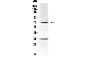 Western blot analysis of Alpha 1 Fetoprotein using anti-Alpha 1 Fetoprotein antibody . (alpha Fetoprotein anticorps  (AA 19-254))