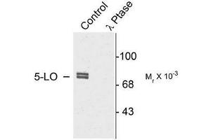 Image no. 1 for anti-Arachidonate 5-Lipoxygenase (ALOX5) (pSer523) antibody (ABIN372586) (ALOX5 anticorps  (pSer523))