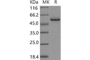Western Blotting (WB) image for Glucose-Fructose Oxidoreductase Domain Containing 2 (GFOD2) protein (His tag) (ABIN7320021)